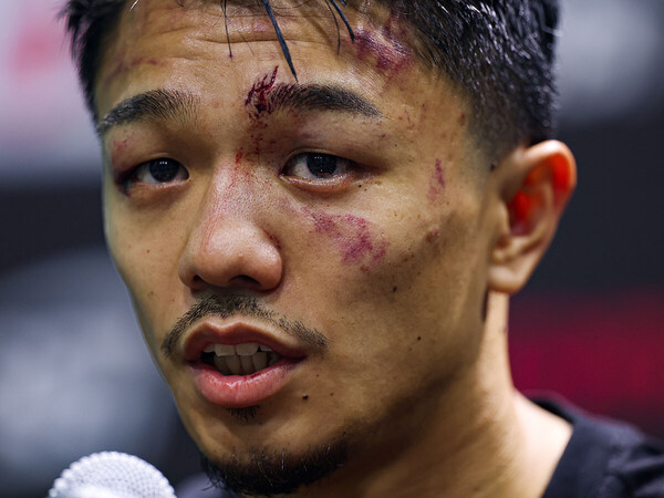 試合後の会見に臨んだ中谷の顔には、バッティングなどの傷も　photo by Naoki Kitagawa